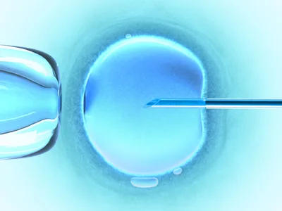 ICSI procedure: a fine glass pipette holds an egg while a thin needle injects a single sperm — one of many IVF lab techniques whose use varies widely between clinics and countries.